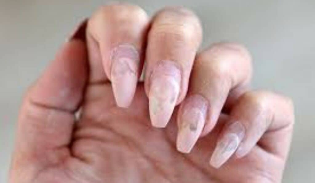 Acryl Nagels Verwijderen