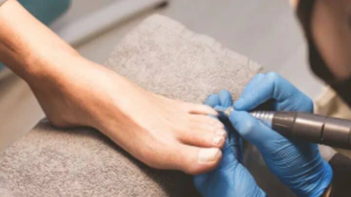 De beste elektrische nagelvijl voor kalknagels en dikke teennagels