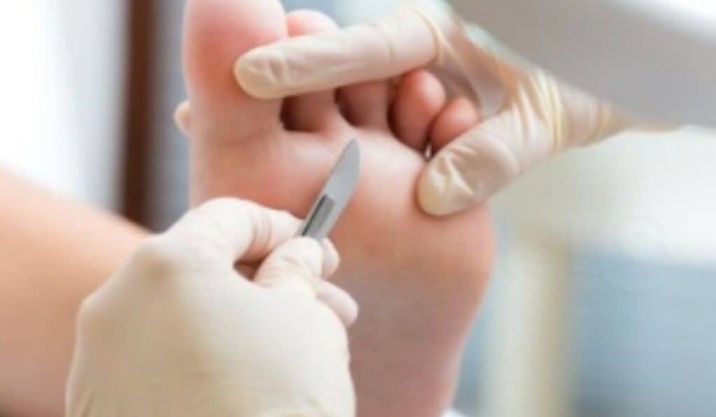 Medische Pedicure