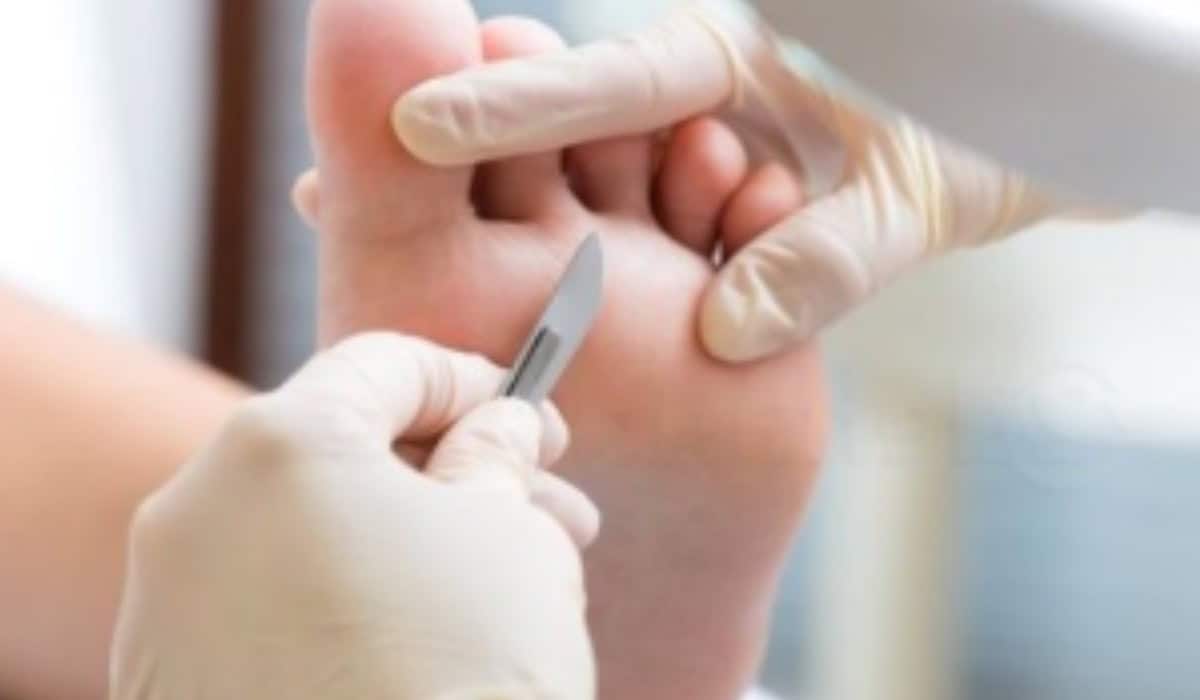 Medisch Pedicure Roermond - Professionele Voetverzorging Medisch Pedicure Roermond - Professionele Voetverzorging