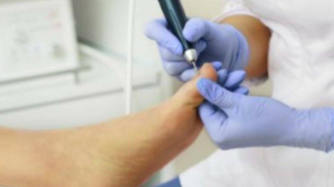 Medische Pedicure: Wat Het Is en Waarom Het Belangrijk Is voor Je Voeten