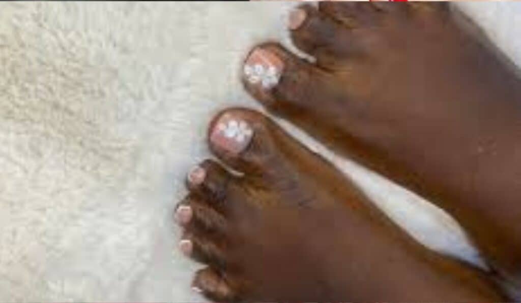 Acrylnagels pedicure