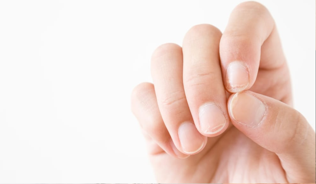 Broze nagels